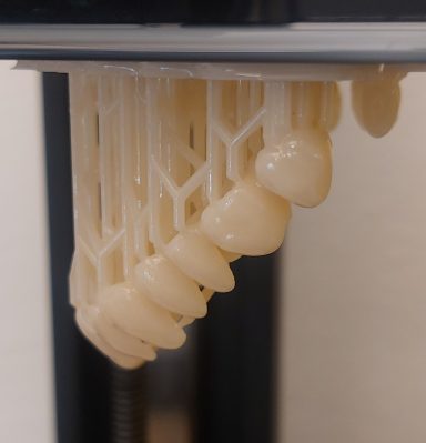 3D-gedruckter Zahnkranz